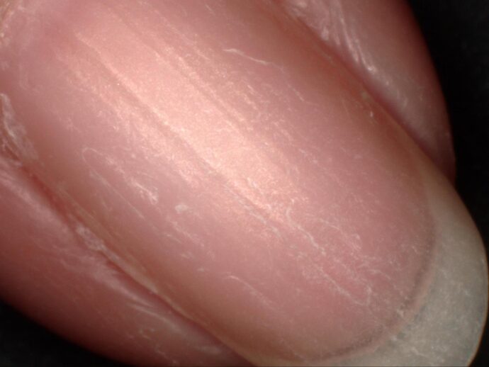 爪の表面を顕微鏡で拡大撮影した写真